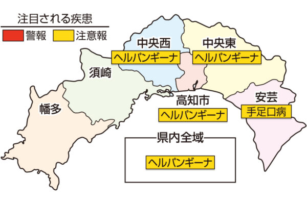 教えて 吉川先生 夏の風邪 ヘルパンギーナ 手足口病 咽頭結膜熱 ココハレ 高知の子育て応援ウェブメディア