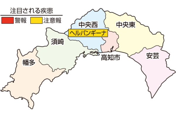 ノロウイルスの症状は 嘔吐 下痢への対応は 教えて 吉川先生 感染性胃腸炎 ココハレ 高知の子育て応援ウェブメディア