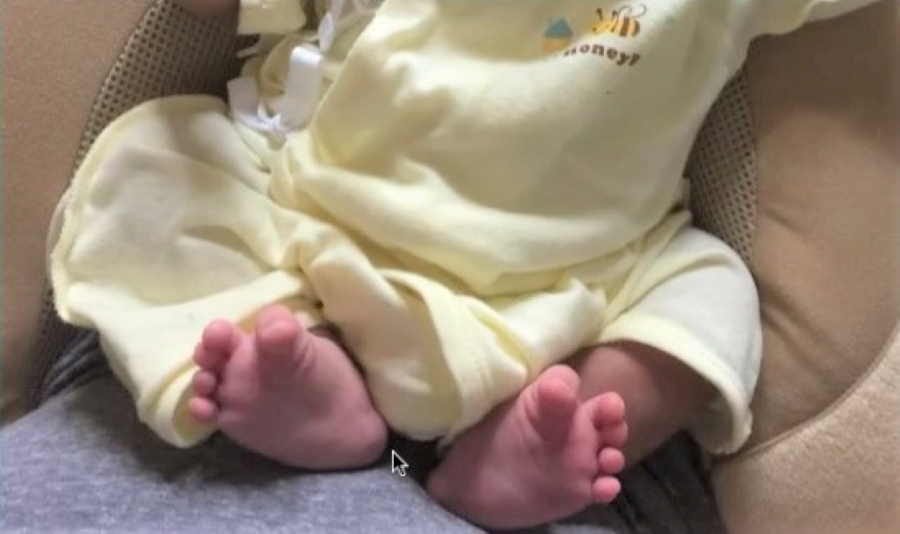 生後1カ月の赤ちゃんの足。よく見ると…？