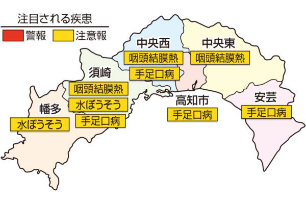 RSウイルス感染症が高知県内で過去最多ペースで増えています