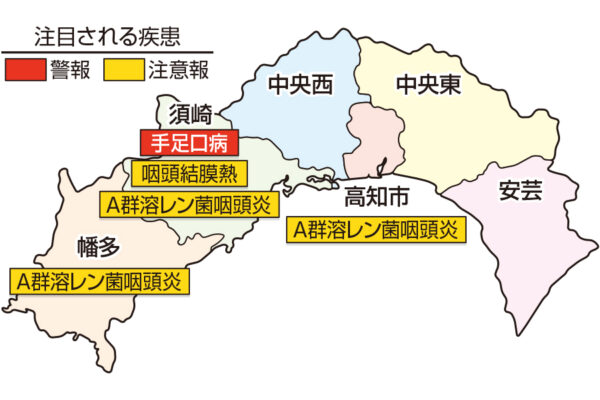 【2022年9～11月】高知市の桂浜公園で「龍馬に大接近」｜高さ13メートルの特設展望台に上れます