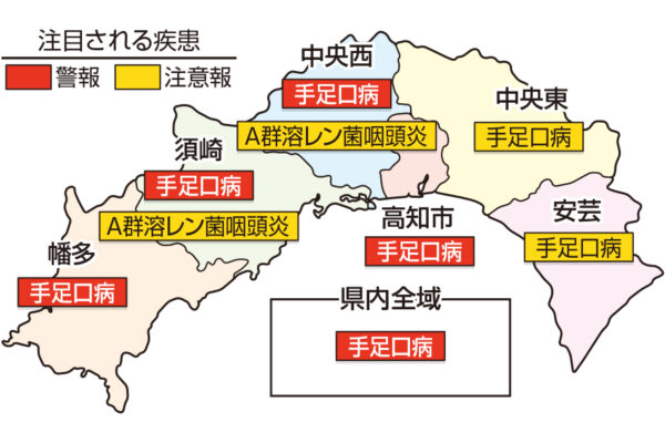 手足口病が高知県全域、高知市、中央西、須崎、幡多で警報です｜高知県の感染症情報（2024年11月11～17日）