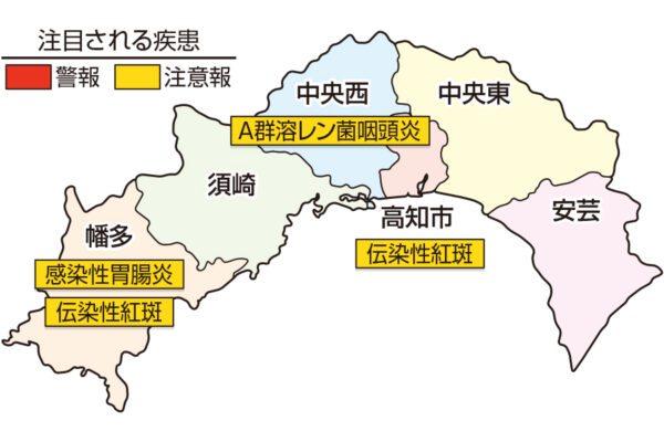 「教えて！吉川先生」水痘（水ぼうそう）｜体に発疹ができ、かゆみを伴います