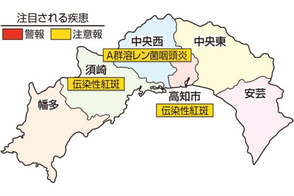 A群溶レン菌咽頭炎が中央西で注意報、伝染性紅斑が高知市、須崎で注意報です｜高知県の感染症情報（2025年4月21～27日）