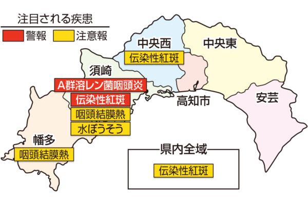 A群溶レン菌咽頭炎が須崎で警報、伝染性紅斑が須崎で警報、県全域と中央西で注意報です｜高知県の感染症情報（2025年5月12～18日）
