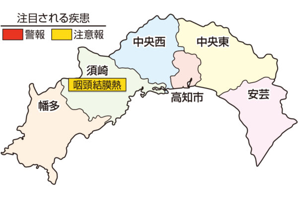 咽頭結膜熱が須崎で注意報です｜高知県の感染症情報（2025年5月5～11日）
