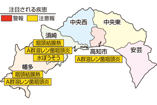 A群溶レン菌咽頭炎が高知市、須崎、幡多で注意報です｜高知県の感染症情報（2025年5月19～25日）