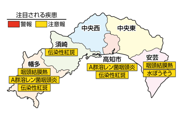 A群溶レン菌咽頭炎が高知市、幡多で注意報。百日咳が1週間で100人以上報告されました｜高知県の感染症情報（2025年6月16～22日）