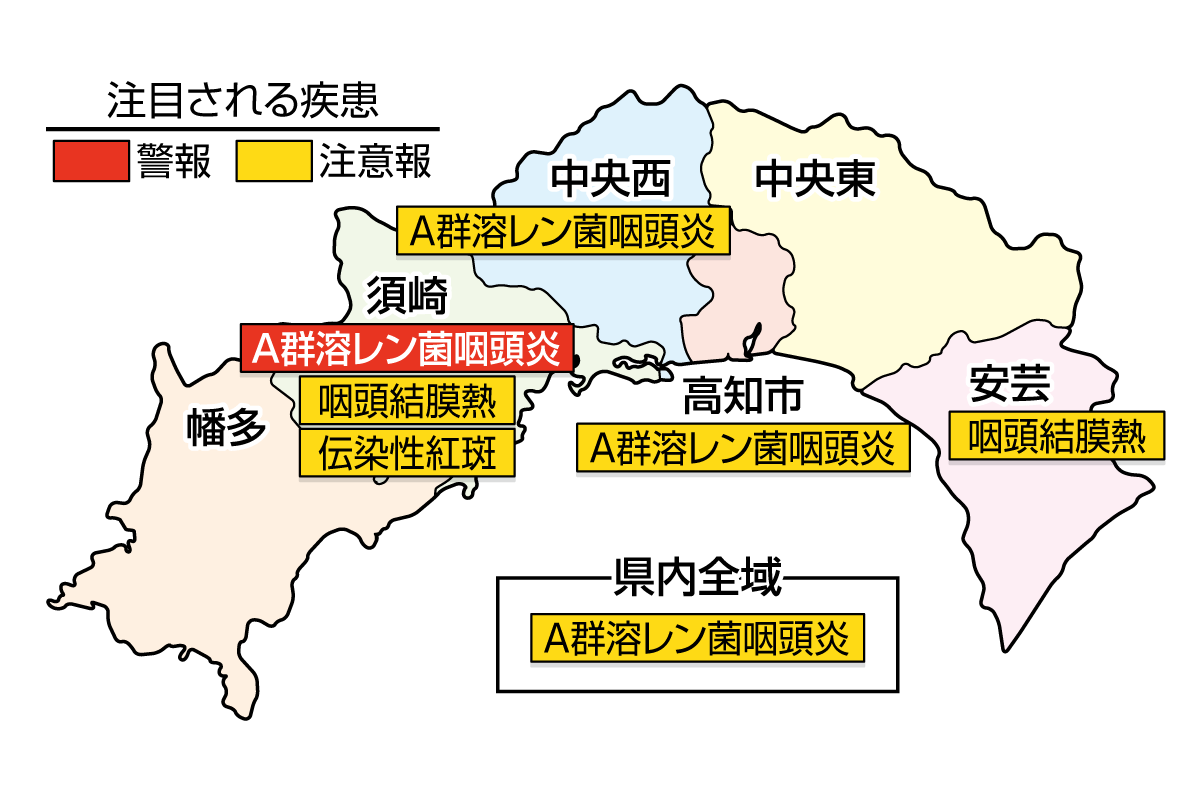 A群溶レン菌咽頭炎が須崎で警報、高知県全域で注意報です｜高知県の感染症情報（2025年6月2～8日）