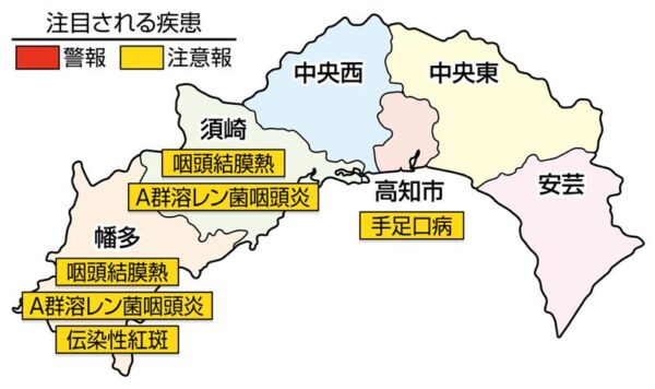 A群溶レン菌咽頭炎が須崎、幡多で注意報。手足口病が高知市で注意報です｜高知県の感染症情報（2025年6月9～15日）