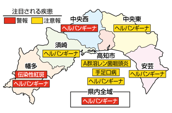 ヘルパンギーナが中央西、幡多、高知県全域で警報です｜高知県の感染症情報（2025年7月7～13日）