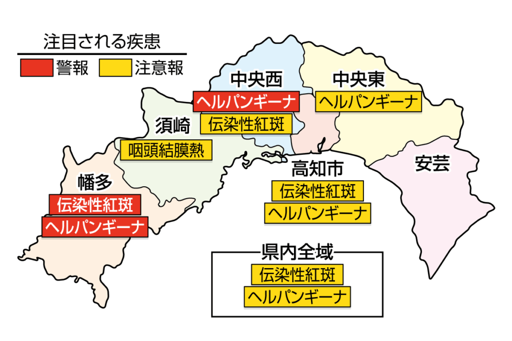 ヘルパンギーナが中央西、幡多で警報、高知県全域で注意報です｜高知県の感染症情報（2025年7月21～27日）