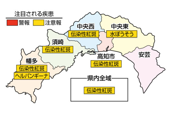 RSウイルス感染症が高知県内で過去最多ペースで増えています