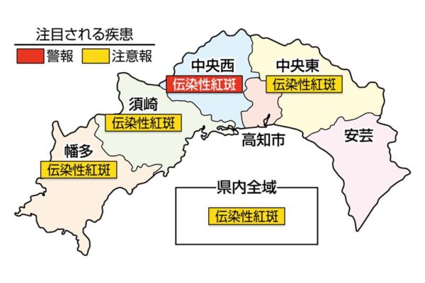 伝染性紅斑が中央西で警報、高知県全域で注意報です｜高知県の感染症情報（2025年9月29日～10月5日）