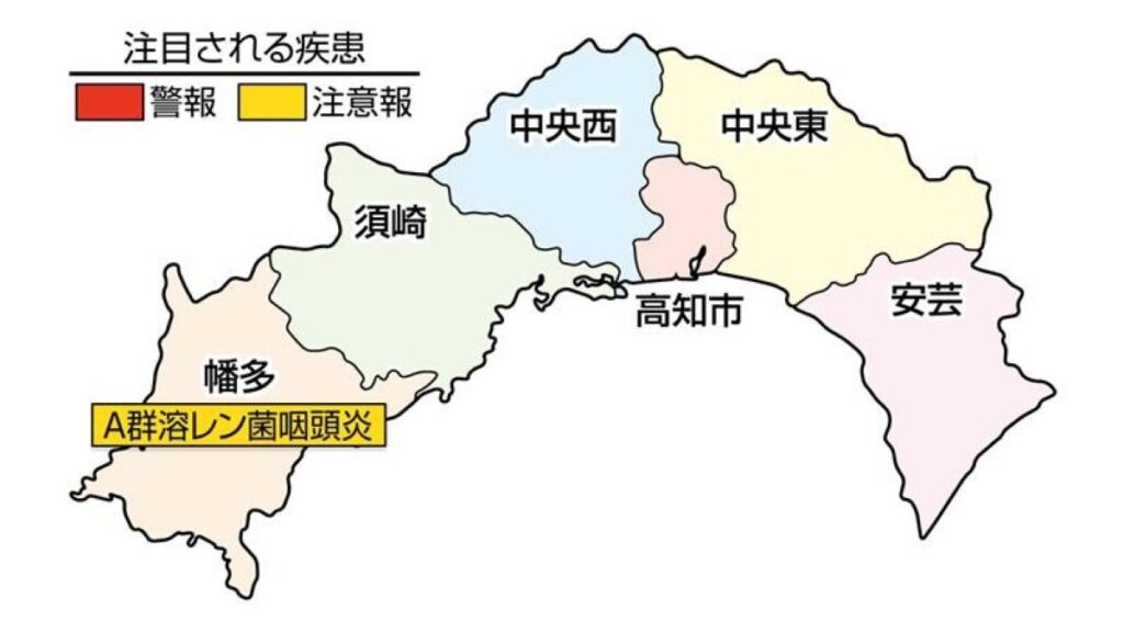A 群溶血性レンサ球菌咽頭炎が幡多、中央西で急増しています｜高知県の感染症情報（2026年4月13～19日）