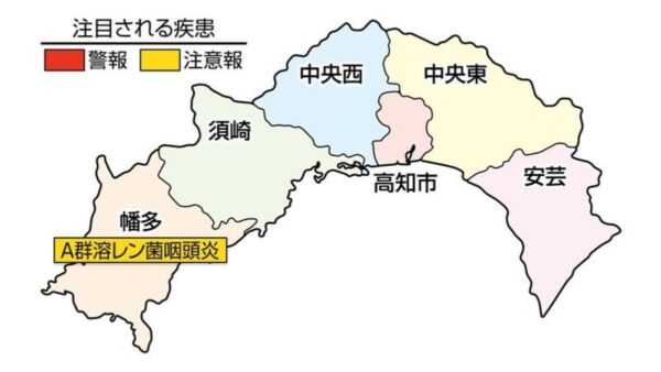 A 群溶血性レンサ球菌咽頭炎が幡多、中央西で急増しています｜高知県の感染症情報（2026年4月13～19日）