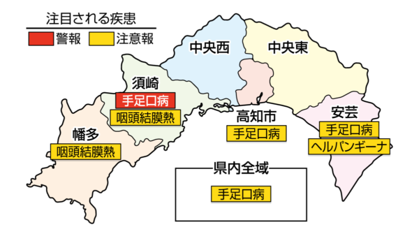 手足口病が須崎で警報、高知県全域で注意報です｜高知県の感染症情報（2026年6月15～21日）